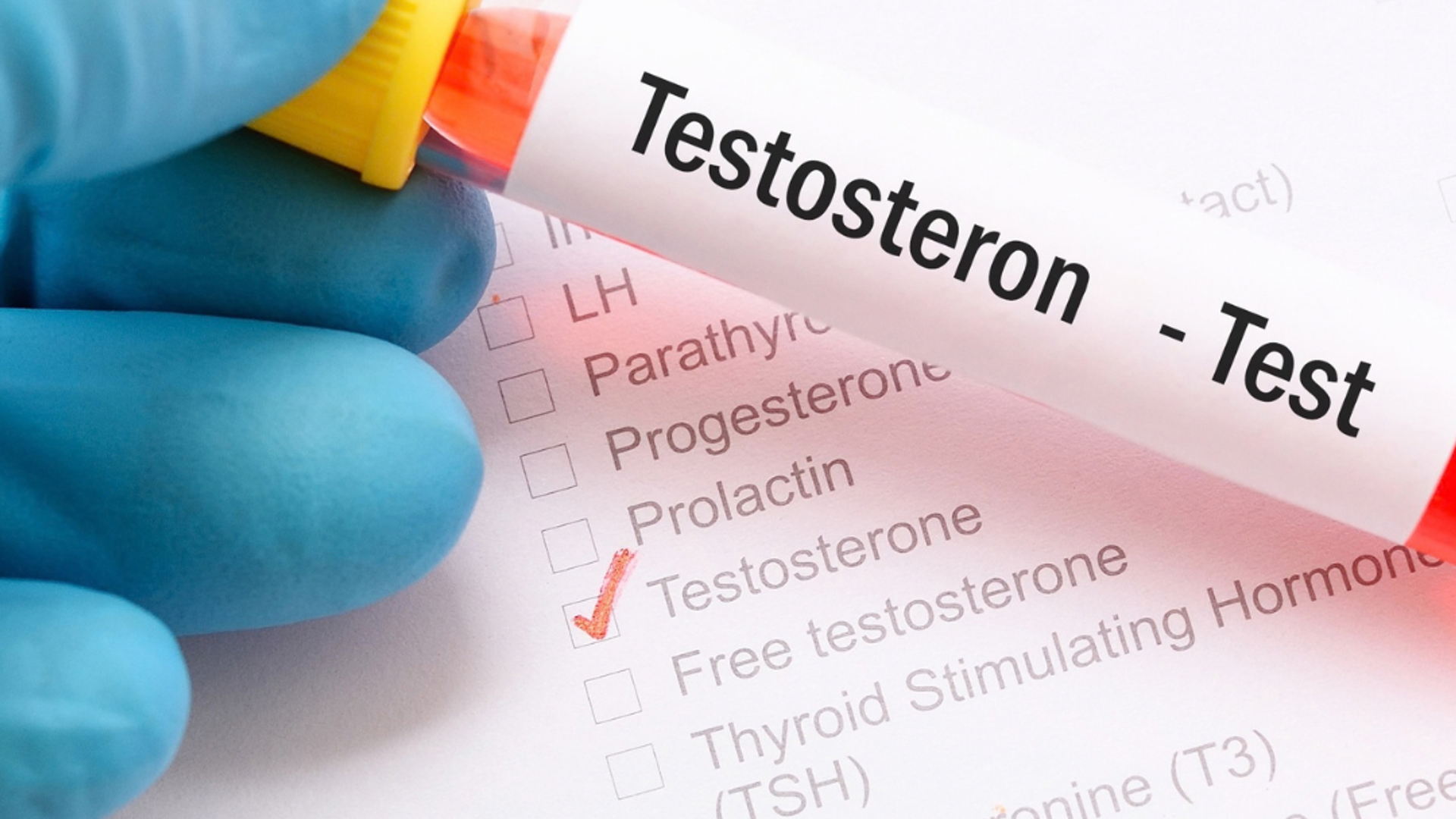 Testosteron in de overgang I FemmePrex